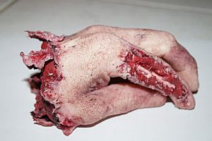 Abgetrennte Hand